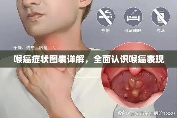 喉癌症状图表详解，全面认识喉癌表现