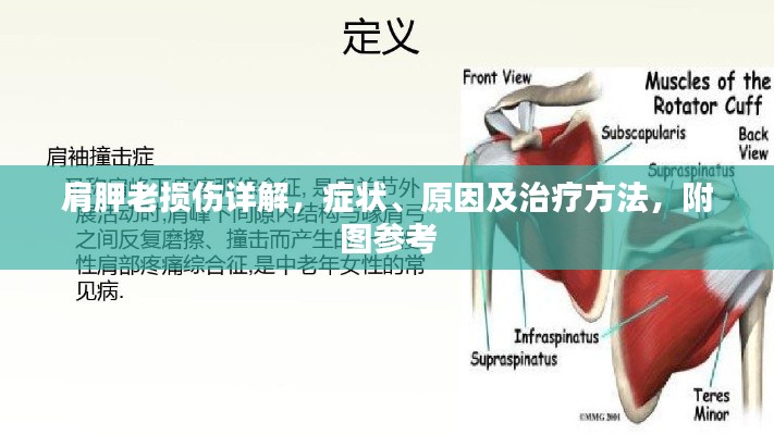 肩胛老损伤详解，症状、原因及治疗方法，附图参考