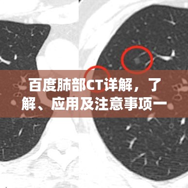 百度肺部CT详解，了解、应用及注意事项一网打尽
