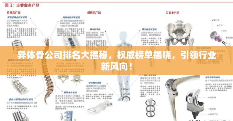 异体骨公司排名大揭秘，权威榜单揭晓，引领行业新风向！